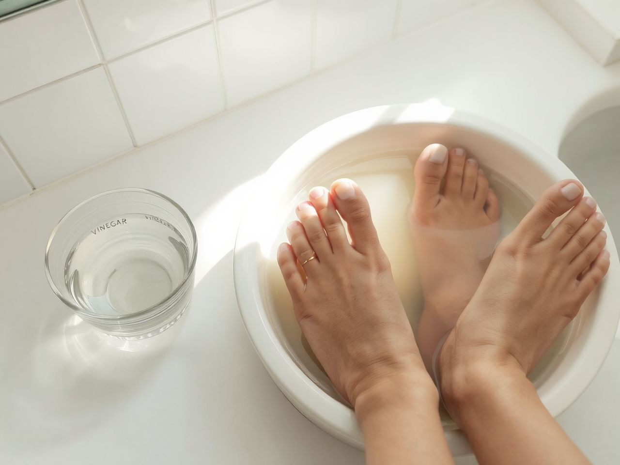 Az ecet savassága gátolja a körömgomba terjedését hatékonyan.